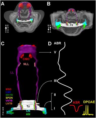 Central Auditory and Vestibular Dysfunction Are Key Features of Autism Spectrum Disorder
